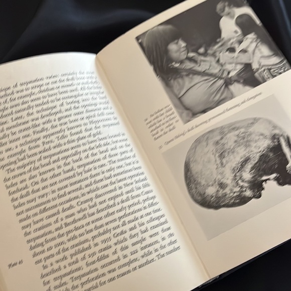 Vintage ‘The Human Skull…A Cultural Story’ HB/DJ~1966 - Picture 7 of 13